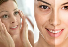 ¿Cuáles son los mejores tratamientos antiedad?